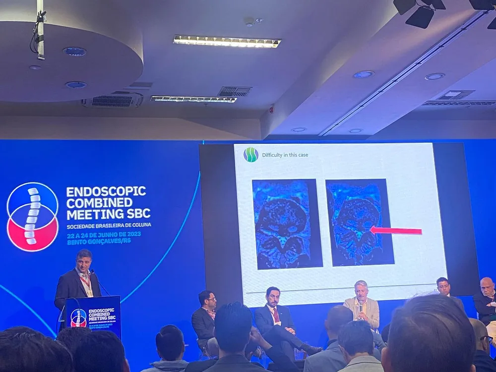 Endoscopic Combined Meeting da Sociedade Brasileira de Coluna